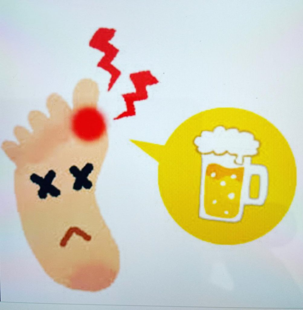 #痛風尿酸が体の中にたまり結晶となって、激しい関節炎を伴う症状。