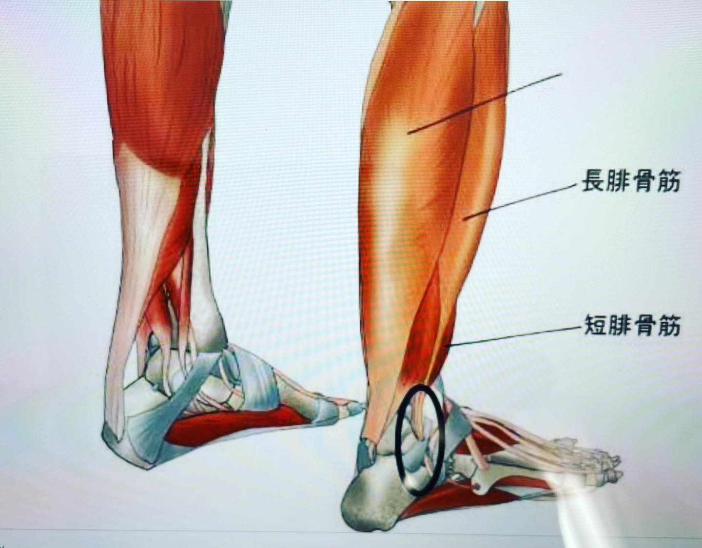 #足首トレーニング 膝下内側の筋肉は後脛骨筋、外側の筋肉は腓骨筋です。内側の筋肉が弱くなると外反母趾になりやすい。外側の筋肉が弱くなると、足首やかかとが痛くなる。トレーニングは、膝を曲げる　　足首をまっすぐ伸ばす　　足指をぎゅっと握る　　そのままで足先を内側、外側に10秒づつむける。