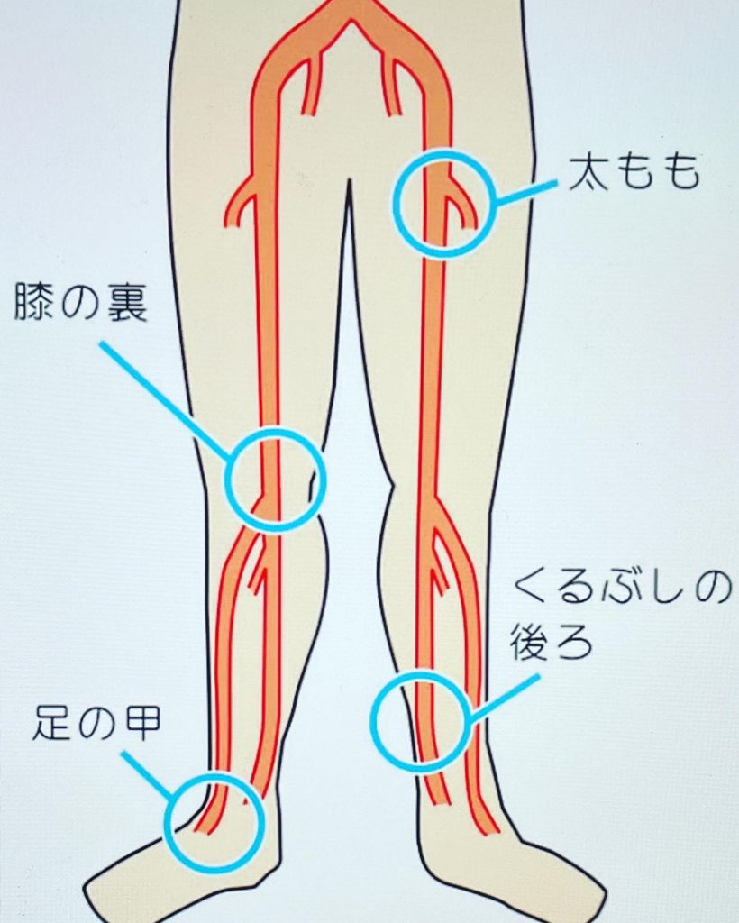 #足の動脈硬化！足のしびれや冷たさ、見た目足の指が青白くなる。